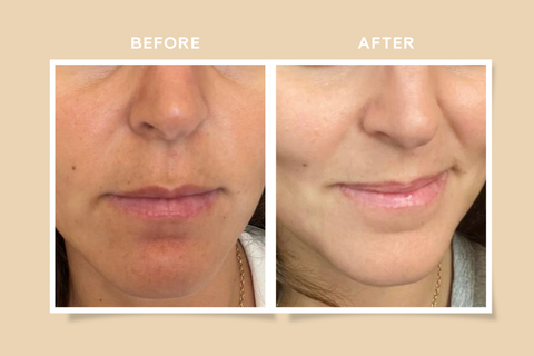 How to Restore an Even Complexion with Helwé’s Natural Routine in less than 4 months?