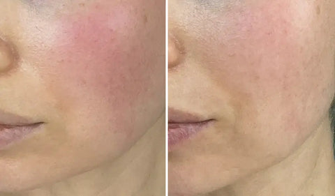 Calm & Soothe Skin Repair Program